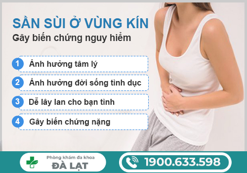 Hình ảnh minh họa